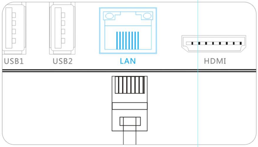 网络机顶盒怎么安装使用?网络机顶盒安装步骤和使用方法